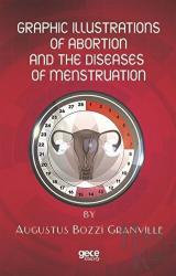 Graphic Illustrations Of Abortion And The Diseases Of Menstruation