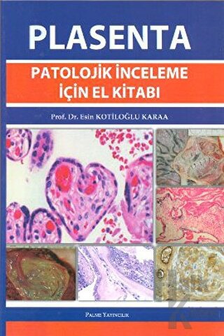 Plasenta Patolojik İnceleme İçin El Kitabı - Halkkitabevi
